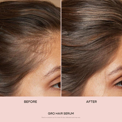 VEGAMOUR GRO Hair Serum for Thinning & Shedding, Thicker Fuller Looking Hair In As Soon As 90 Days, Non Oily, Bergamot Scent, Vegan & Cruelty Free